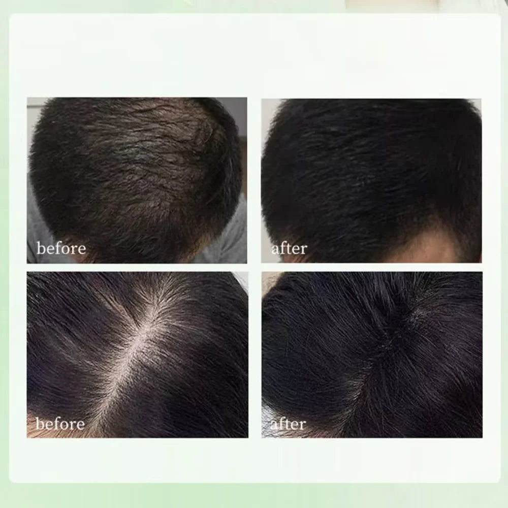 Shampoo/sabonete herbal natural feito à mão com ervas (Usman Grass), para nutrição do cabelo, controle de oleosidade, sensação refrescante e cuidado capilar que deixa o cabelo leve e macio.